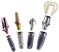 Implanty Dental Complex