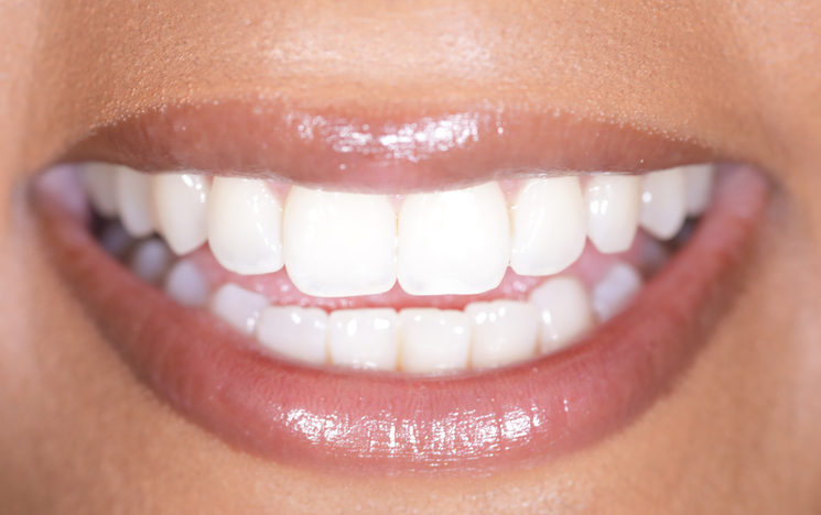 Jakie są główne metody wybielania zębów? 